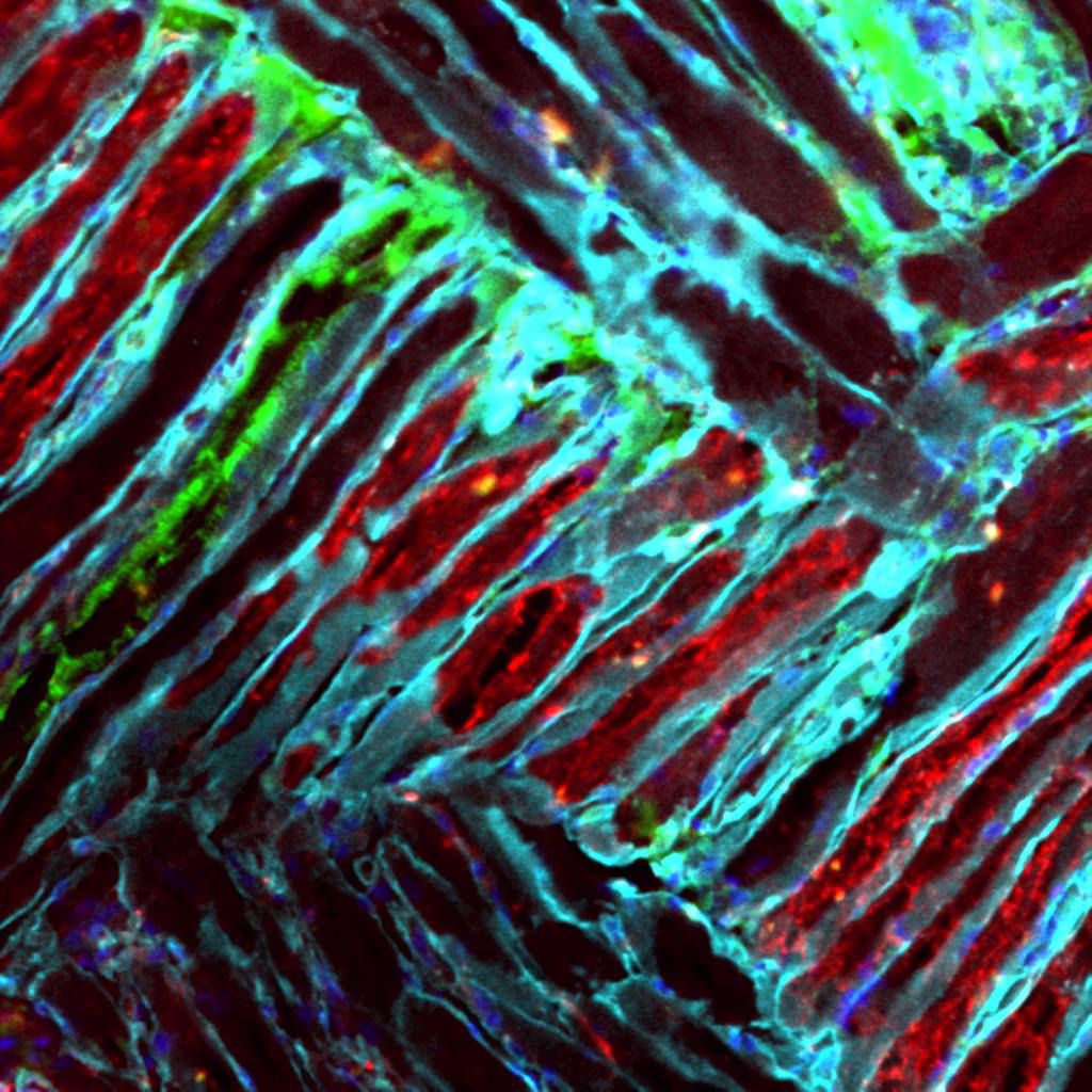 Tongue muscle
